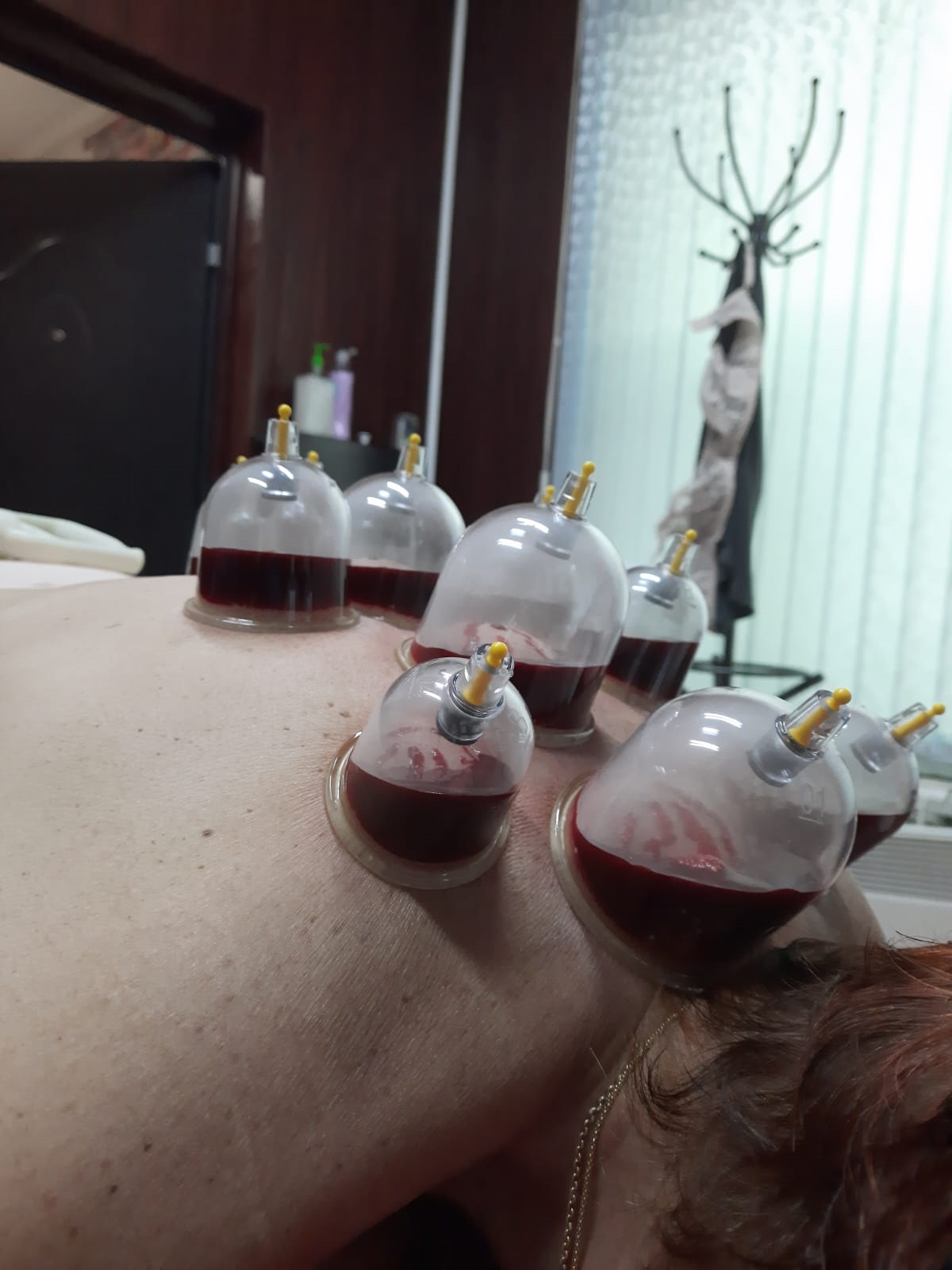 Курсы хиджамы в Москве